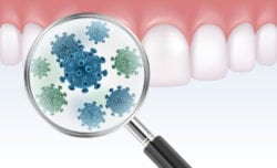 gum disease periodontal disease bleeding gums florence sc