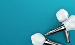 affordable dental implants in florence, south carolina