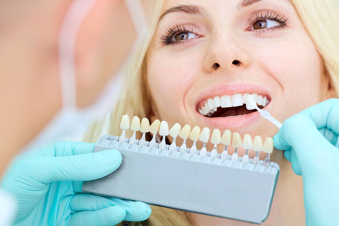 oral health benefits with porcelain veneers in Florence South Carolina