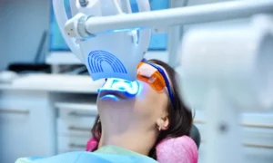 Why Invest in Professional Teeth Whitening in Florence, SC